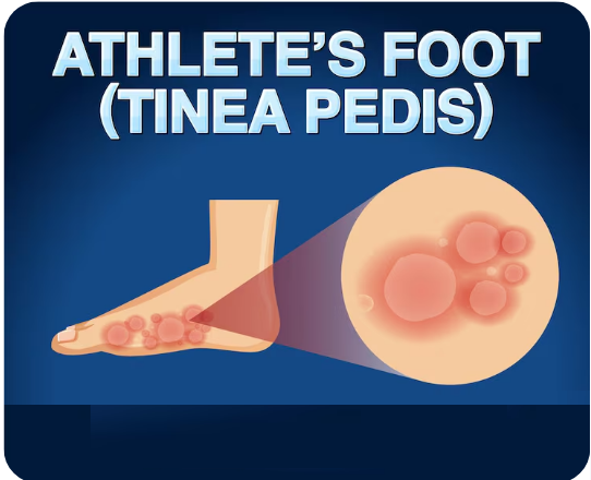درمان پای دیابتی دکتر فرشاد احمدی