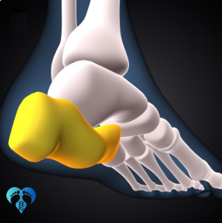 کاردرمانی خار پاشنه..