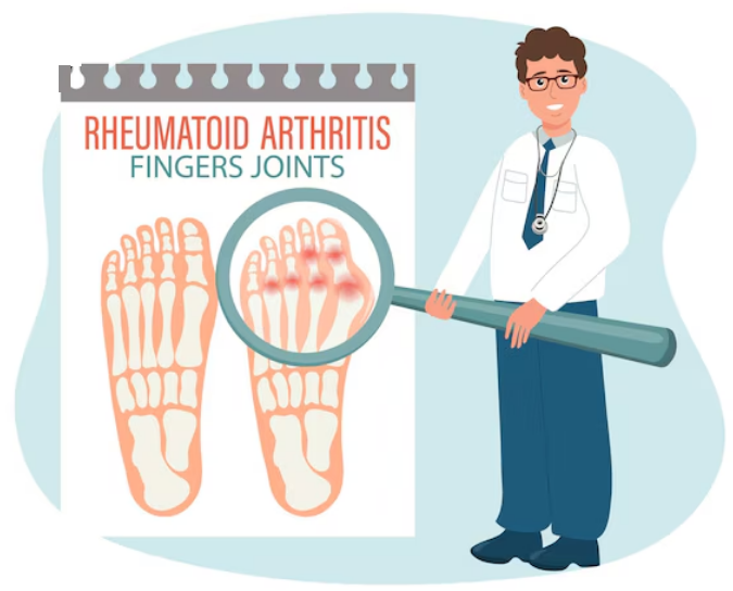 کج شدن انگشت شست پا (بونیون).........